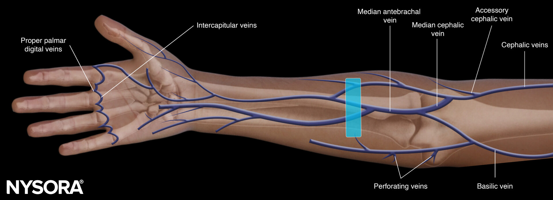 Peripheral vascular access