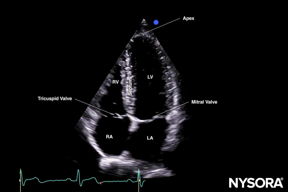 Cardiac and Hemodynamic Assessment
