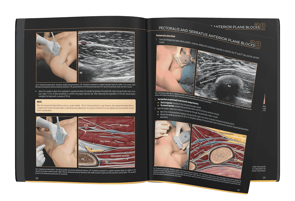 Nerve Block Manual